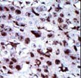 AK5 / Adenylate Kinase 5 Antibody (aa404-433)
