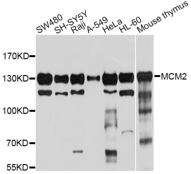 MCM2 Antibody