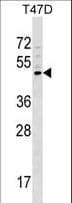 GCNT1 / C2GNT Antibody (aa63-91)