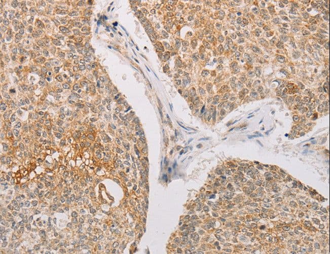 STK40 Antibody