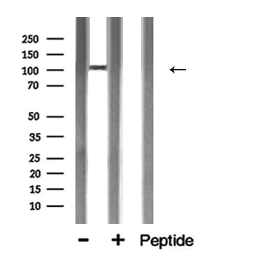 Polyclonal Rabbit anti-Human ACE2 / ACE-2 Antibody (IF, WB)