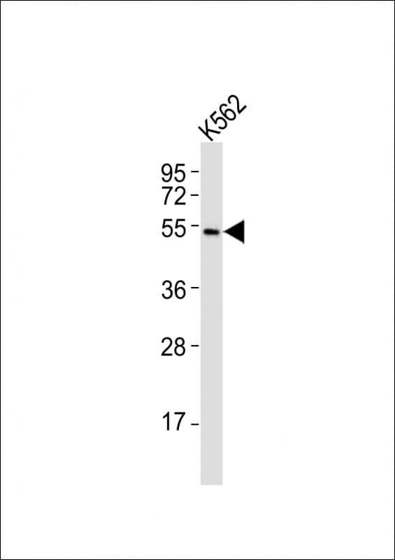 Polyclonal Rabbit anti-Mouse BAF60C / SMARCD3 Antibody (aa158-193, WB)