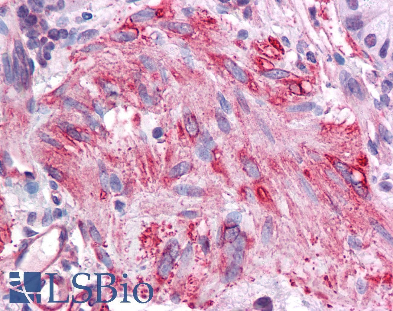 SIRT5 / Sirtuin 5 Antibody (aa179-228)