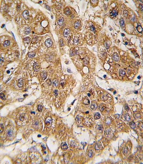 Polyclonal Rabbit anti-Human APOE / Apolipoprotein E Antibody (aa263-292, IHC, WB)