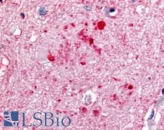 PathPlus™ Polyclonal Rabbit anti-Human PRKCZ / PKC-Zeta Antibody (N-Terminus, IHC)