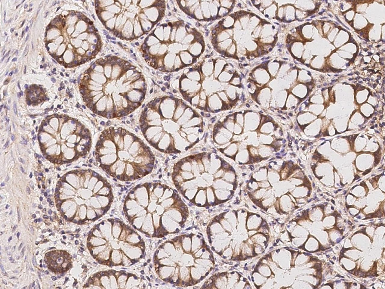 Polyclonal Rabbit anti-Human PHACTR4 Antibody (IHC)