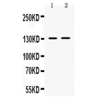 TRPM5 Antibody (aa1021-1108)