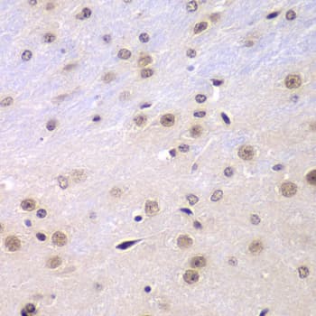 RNF2 / RING2 / RING1B Antibody