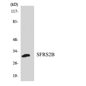 Polyclonal Rabbit anti-Human SRSF8 Antibody (aa23-72, WB)