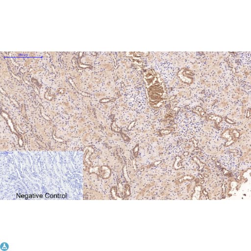 Monoclonal Mouse anti-Human TUBG1 / Tubulin Gamma 1 Antibody (IHC)