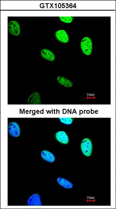 IHC-plus™ BRCC45 / BRE Antibody