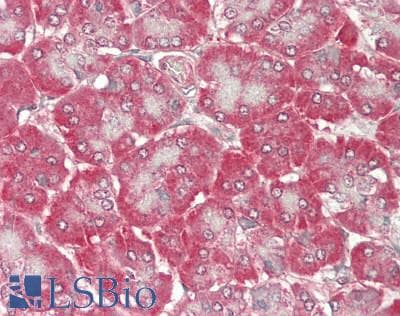 PROS1 / Protein S Antibody (aa481-667)