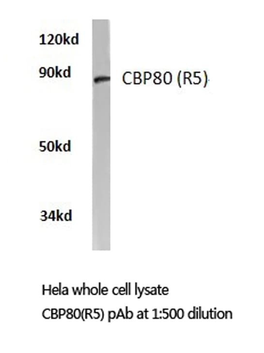NCBP1 / CBP80 Antibody (Arg5)