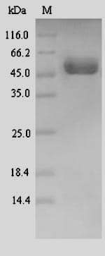 Human C1orf187 / DRAXIN Protein (Recombinant 6His-SUMO, N-terminus)