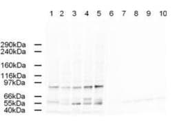 IHC-plus™ Polyclonal Goat anti-Human TFAP2A / AP-2 Antibody (aa1-25, IHC, WB)
