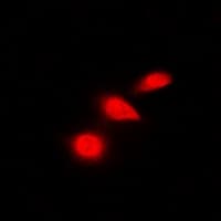 TP53 / p53 Antibody (C-Terminus)