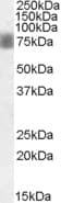 Polyclonal Goat anti-Human NUAK1 / ARK5 Antibody (aa654-668, IF)