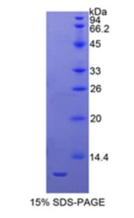 Human MUC21 Protein (Recombinant His, N-Terminal)