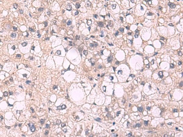 Polyclonal Rabbit anti-Human KPNA2 / Importin Alpha 1 Antibody (IHC, WB)