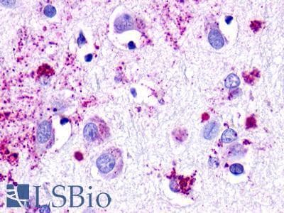 PathPlus™ Polyclonal Rabbit anti-Human NMUR1 Antibody (Cytoplasmic Domain, IHC)