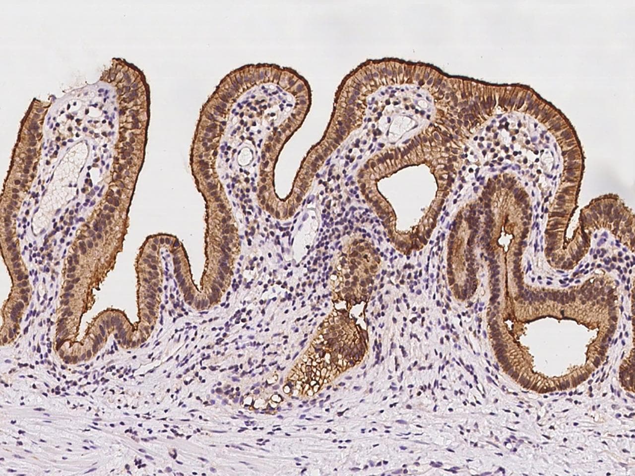 Polyclonal Rabbit anti-Human SLC15A1 / PEPT1 Antibody (IHC, IF)