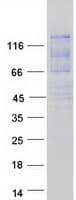 Human ATXN2L Protein (Recombinant Myc-DDK (Flag))