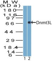 Polyclonal Rabbit anti-Human DNMT3L Antibody (aa25-75, IHC, WB)