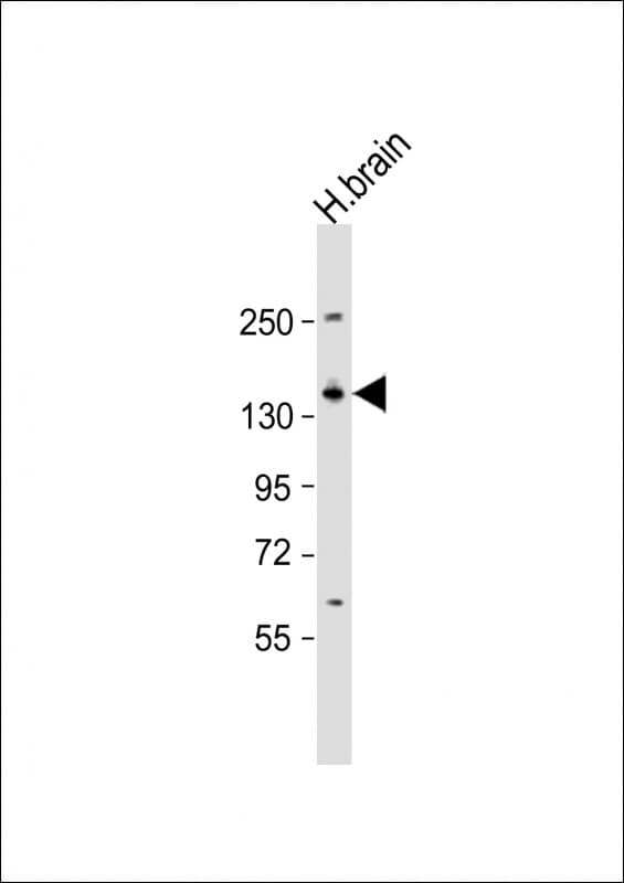 KCNMA1 / BK Antibody (aa118-152)