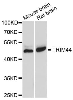 Polyclonal Rabbit anti-Human TRIM44 Antibody (IHC, WB)