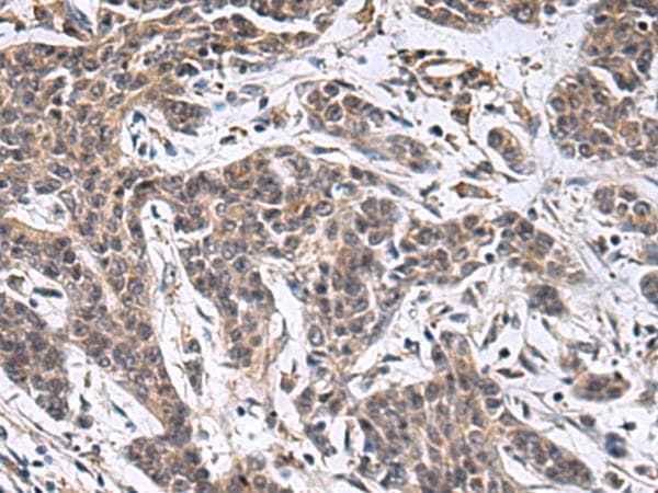 MBL2 / Mannose Binding Protein Antibody