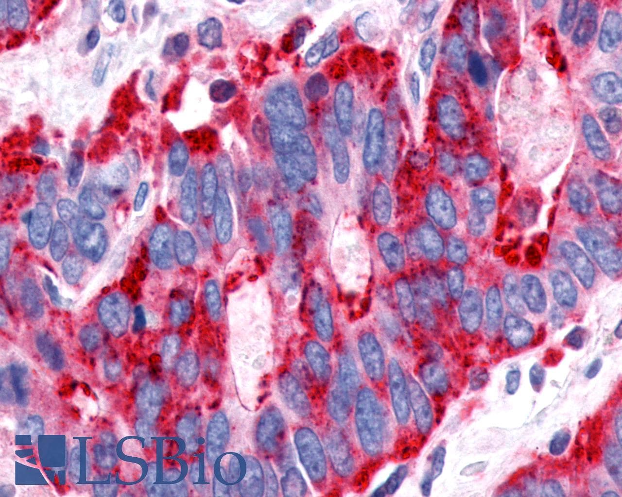 PathPlus™ P2Y13 / P2RY13 Antibody (Cytoplasmic Domain)