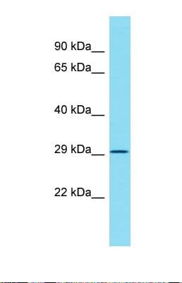ATPAF2 Antibody (aa101-150)