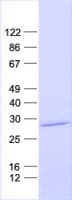 Human C21orf62 Protein (Recombinant His, N-Terminal)