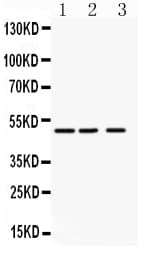 Polyclonal Rabbit anti-Human ANGPTL4 Antibody (aa349-367, WB)