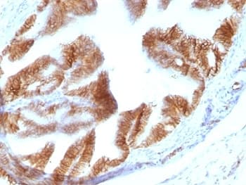 EPCAM Antibody (Cytoplasmic Domain, clone EGP40/1110, Ready-to-Use)