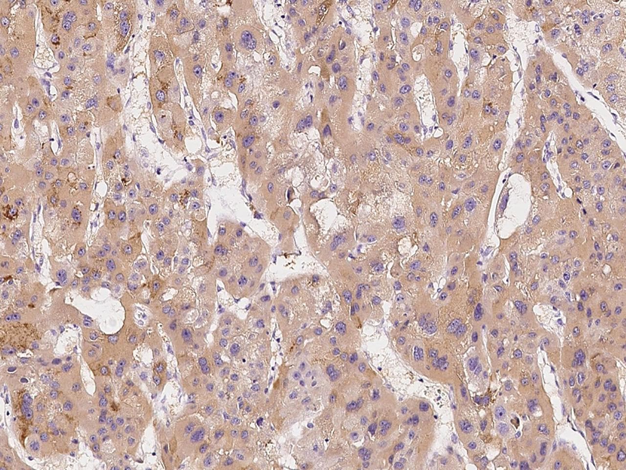 MSMB / MSP Antibody (Preservative Free)