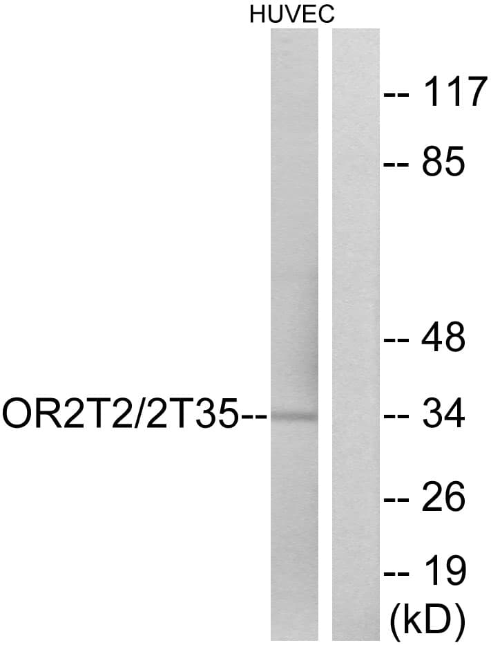 OR2T35 Antibody (aa201-250)