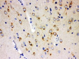 ABI1 / SSH3BP1 Antibody
