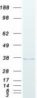 Human DNTTIP1 / TDIF1 Protein (Recombinant Myc-DDK (Flag))