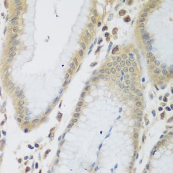 ENPEP / Aminopeptidase A Antibody