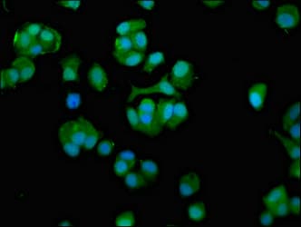 CCT7 Antibody