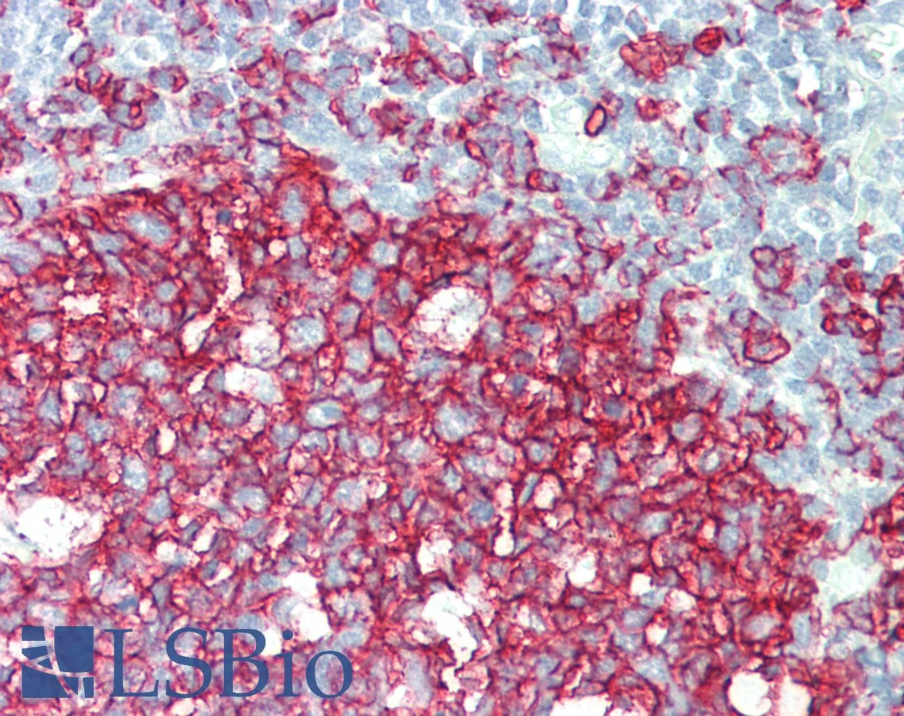IHC-plus™ CD20 Antibody (aa284-297)