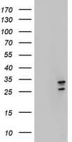 MORF4 Antibody (aa1-255, clone OTI5F2, Carrier-free)