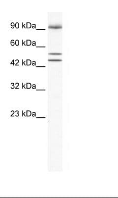 BRD2 / RING3 Antibody (aa524-573)