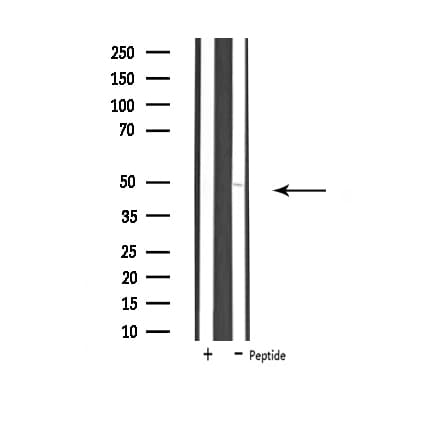UBFD1 Antibody