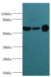 IHC-plus™ Polyclonal Rabbit anti-Human GLUD2 Antibody (aa319-558, IHC, WB)