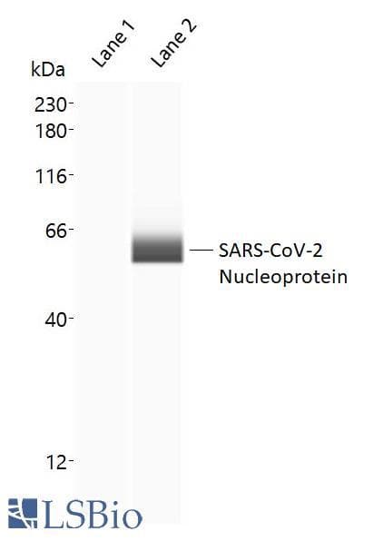 SARS-CoV-2 Nucleoprotein Antibody