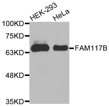 FAM117B / ALS2CR13 Antibody