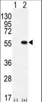 Polyclonal Rabbit anti-Human PRMT2 Antibody (aa344-375, WB)