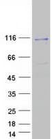 Human VPS11 Protein (Recombinant Myc-DDK (Flag))